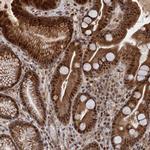 NEK8 Antibody in Immunohistochemistry (Paraffin) (IHC (P))