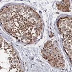 NEK8 Antibody in Immunohistochemistry (Paraffin) (IHC (P))