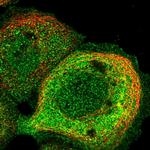 TRPM4 Antibody in Immunocytochemistry (ICC/IF)