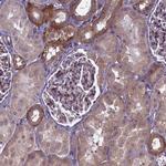 TRPM4 Antibody in Immunohistochemistry (Paraffin) (IHC (P))