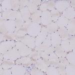 TRPM4 Antibody in Immunohistochemistry (Paraffin) (IHC (P))