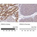 PRDX3 Antibody in Immunohistochemistry (Paraffin) (IHC (P))