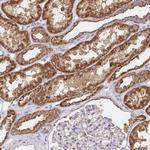 PRDX3 Antibody in Immunohistochemistry (Paraffin) (IHC (P))