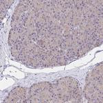 PRDX3 Antibody in Immunohistochemistry (Paraffin) (IHC (P))