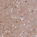 ABAT Antibody in Immunohistochemistry (Paraffin) (IHC (P))