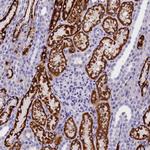 ABAT Antibody in Immunohistochemistry (Paraffin) (IHC (P))