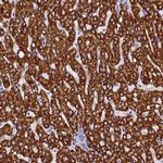 ABAT Antibody in Immunohistochemistry (Paraffin) (IHC (P))