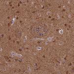 ACK1 Antibody in Immunohistochemistry (Paraffin) (IHC (P))