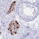 ADAMTS13 Antibody in Immunohistochemistry (Paraffin) (IHC (P))