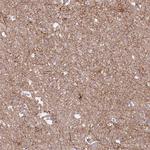 GNAI1 Antibody in Immunohistochemistry (Paraffin) (IHC (P))