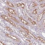 GNAI1 Antibody in Immunohistochemistry (Paraffin) (IHC (P))