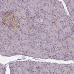 GNAI1 Antibody in Immunohistochemistry (Paraffin) (IHC (P))