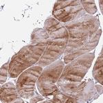 GNAI1 Antibody in Immunohistochemistry (Paraffin) (IHC (P))