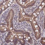 CYP2R1 Antibody in Immunohistochemistry (Paraffin) (IHC (P))