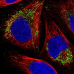 VDAC2 Antibody in Immunocytochemistry (ICC/IF)