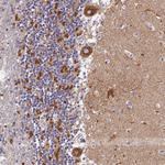 VDAC2 Antibody in Immunohistochemistry (Paraffin) (IHC (P))