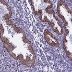 VDAC2 Antibody in Immunohistochemistry (Paraffin) (IHC (P))