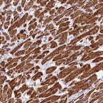 VDAC2 Antibody in Immunohistochemistry (Paraffin) (IHC (P))