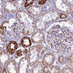 VDAC2 Antibody in Immunohistochemistry (Paraffin) (IHC (P))