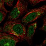 IL17RD Antibody in Immunocytochemistry (ICC/IF)