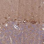 IL17RD Antibody in Immunohistochemistry (Paraffin) (IHC (P))