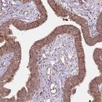 IL17RD Antibody in Immunohistochemistry (Paraffin) (IHC (P))