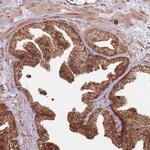 IL17RD Antibody in Immunohistochemistry (Paraffin) (IHC (P))