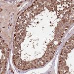 IL17RD Antibody in Immunohistochemistry (Paraffin) (IHC (P))