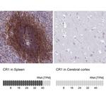 CD35 Antibody in Immunohistochemistry (Paraffin) (IHC (P))