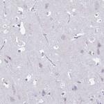 CD35 Antibody in Immunohistochemistry (Paraffin) (IHC (P))