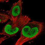 TrxR1 Antibody in Immunocytochemistry (ICC/IF)