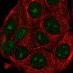 ATG10 Antibody in Immunocytochemistry (ICC/IF)