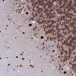 SART3 Antibody in Immunohistochemistry (Paraffin) (IHC (P))