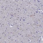 NPY Antibody in Immunohistochemistry (Paraffin) (IHC (P))