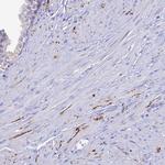 NPY Antibody in Immunohistochemistry (Paraffin) (IHC (P))