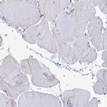 NPY Antibody in Immunohistochemistry (Paraffin) (IHC (P))