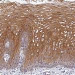 HOXB1 Antibody in Immunohistochemistry (Paraffin) (IHC (P))