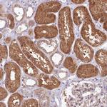 AHCY Antibody in Immunohistochemistry (Paraffin) (IHC (P))