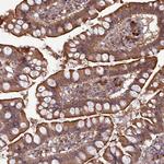 AHCY Antibody in Immunohistochemistry (Paraffin) (IHC (P))