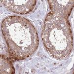 AHCY Antibody in Immunohistochemistry (Paraffin) (IHC (P))