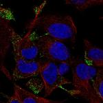 TC10 Antibody in Immunocytochemistry (ICC/IF)