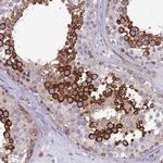 Nodal Antibody in Immunohistochemistry (Paraffin) (IHC (P))