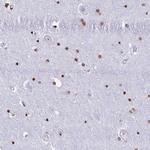 RYK Antibody in Immunohistochemistry (Paraffin) (IHC (P))