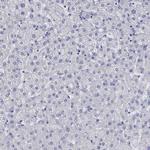 Lass1 Antibody in Immunohistochemistry (Paraffin) (IHC (P))