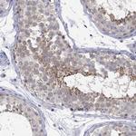 Lass1 Antibody in Immunohistochemistry (Paraffin) (IHC (P))