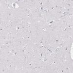 CXCR3 Antibody in Immunohistochemistry (Paraffin) (IHC (P))