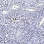 CXCR3 Antibody in Immunohistochemistry (Paraffin) (IHC (P))