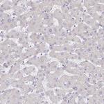 CXCR3 Antibody in Immunohistochemistry (Paraffin) (IHC (P))