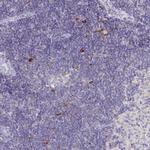 CXCR3 Antibody in Immunohistochemistry (Paraffin) (IHC (P))