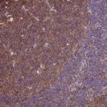 beta Tubulin Antibody in Immunohistochemistry (Paraffin) (IHC (P))